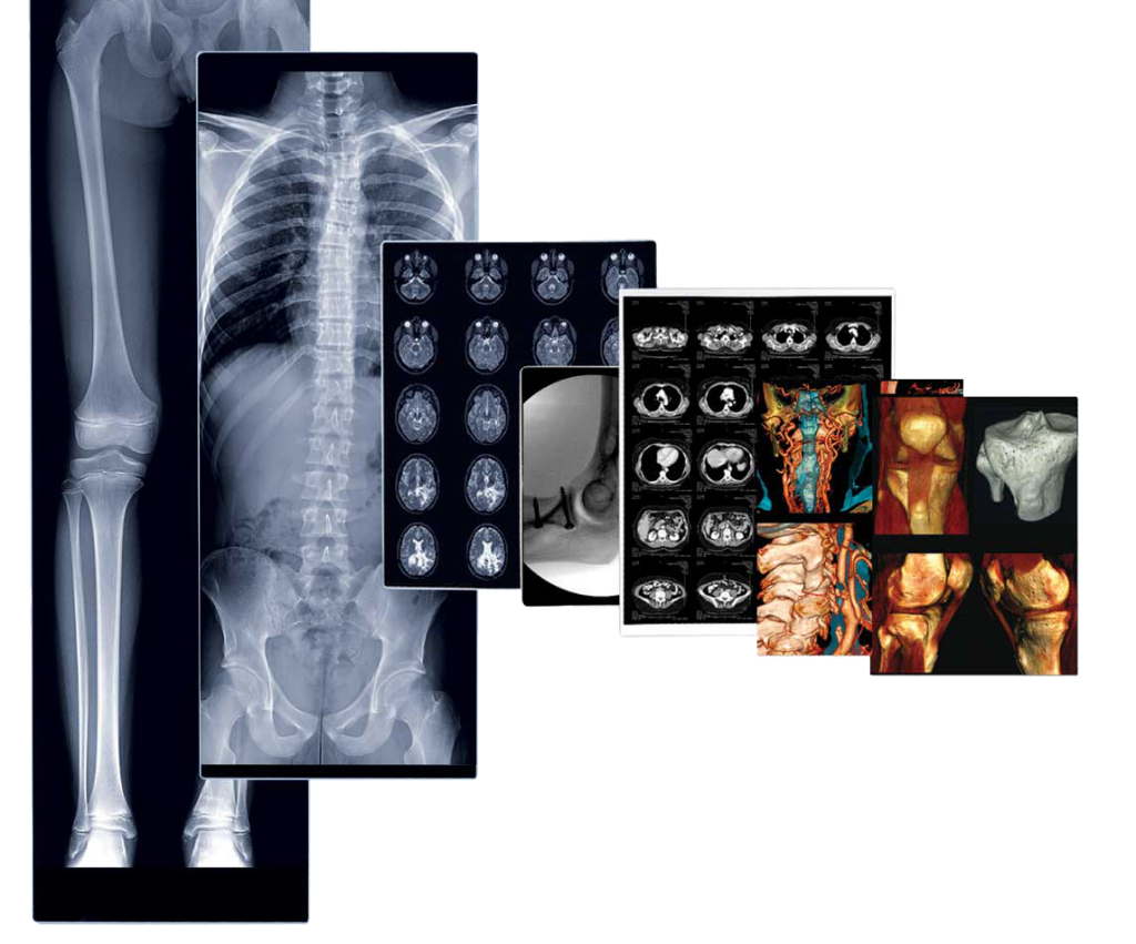 Radiology Products Baslan Ltd.